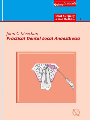 cover image of Practical Dental Local Anaesthesia